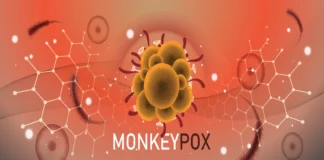 Monkeypox infection says senior health official