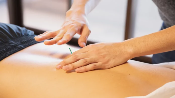 Acupuncture in Los Angeles