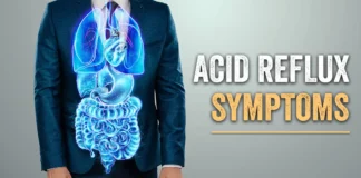 acid reflux symptoms