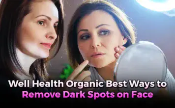 well health organic best ways to remove dark spots on face