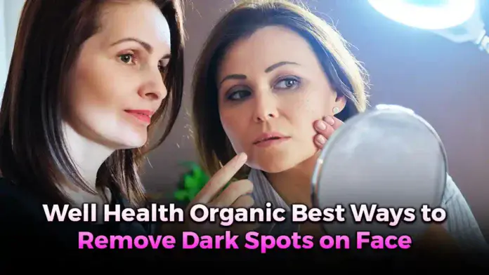 well health organic best ways to remove dark spots on face