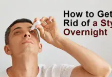 how to get rid of a stye overnight