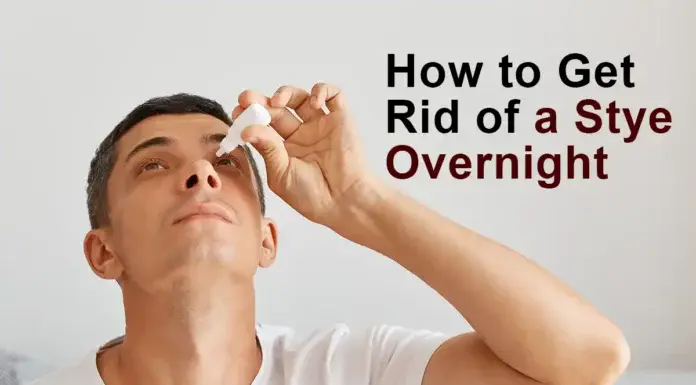 how to get rid of a stye overnight